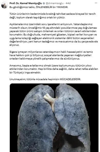 Sağlık Bakanı Memişoğlu Tütün Ürünleri Zararlarına Karşı Yeni Tedbirlerin Sinyalini Verdi